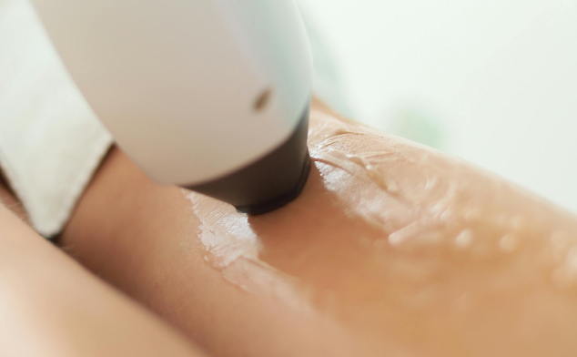 depilacion laser y tatuajes